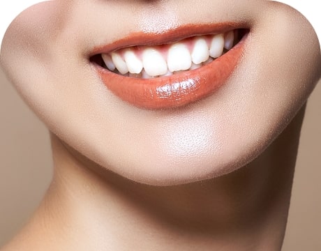 ホワイトニング